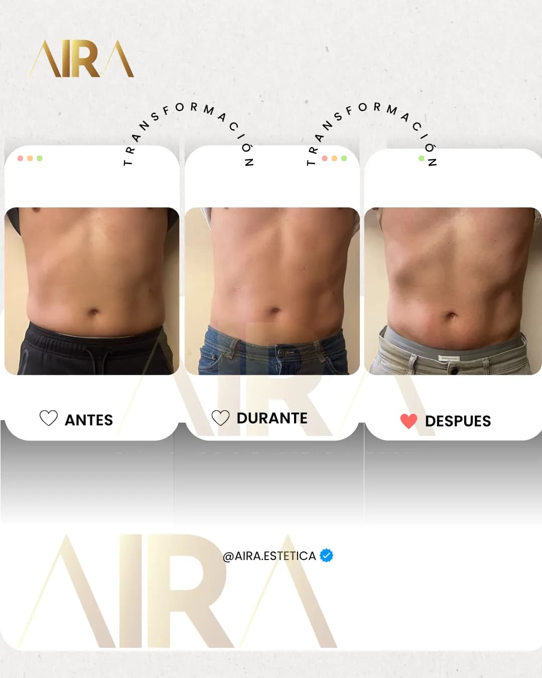 Antes y después de un tratamiento en abdomen masculino